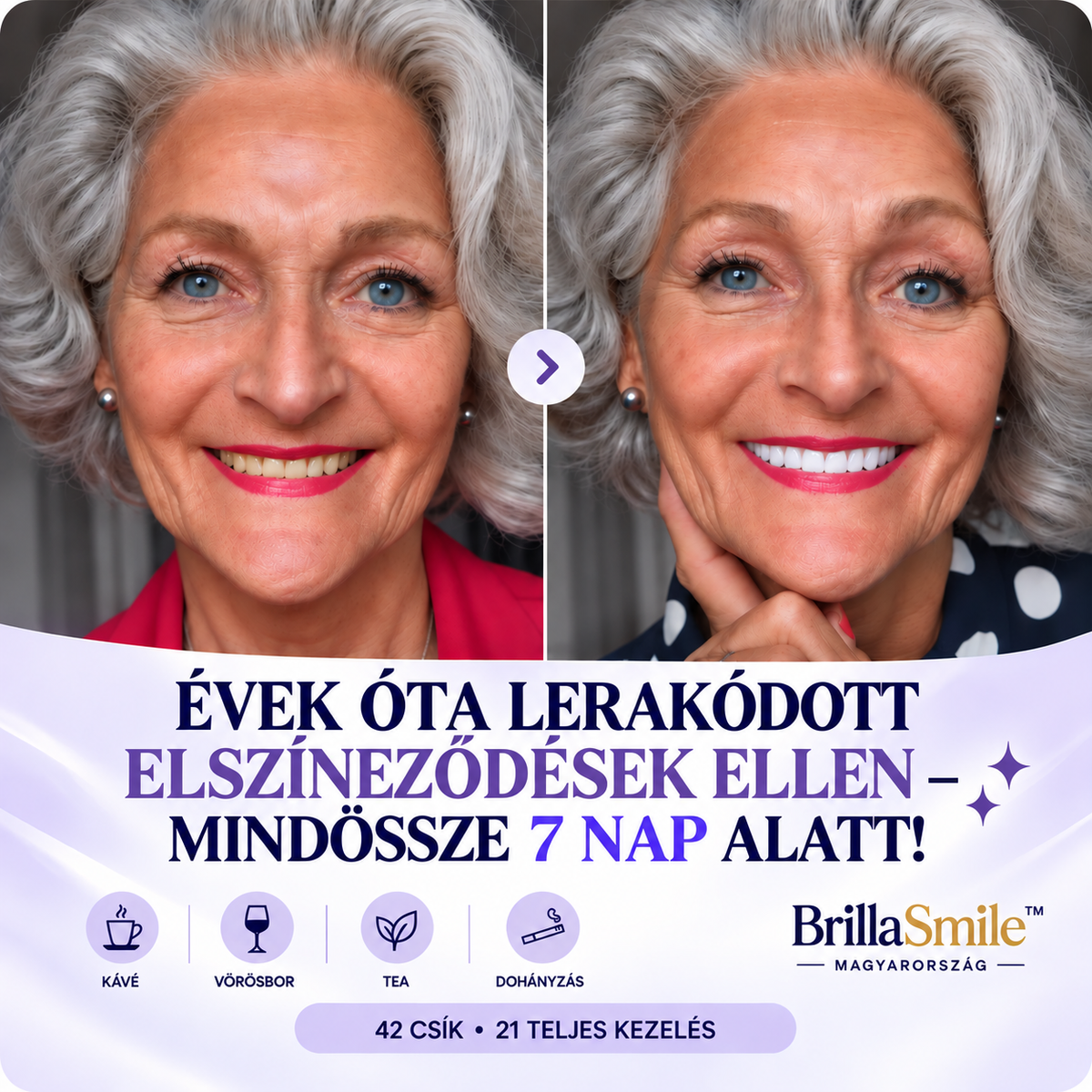 BrillaSmile™ Prémium Fogfehérítő Csíkok